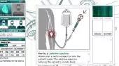 Herzchirurgie