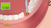 Betätigen Sie nun! Dental Implant