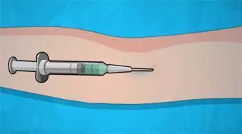 Betätigen Sie nun: Trommelfell Sugery